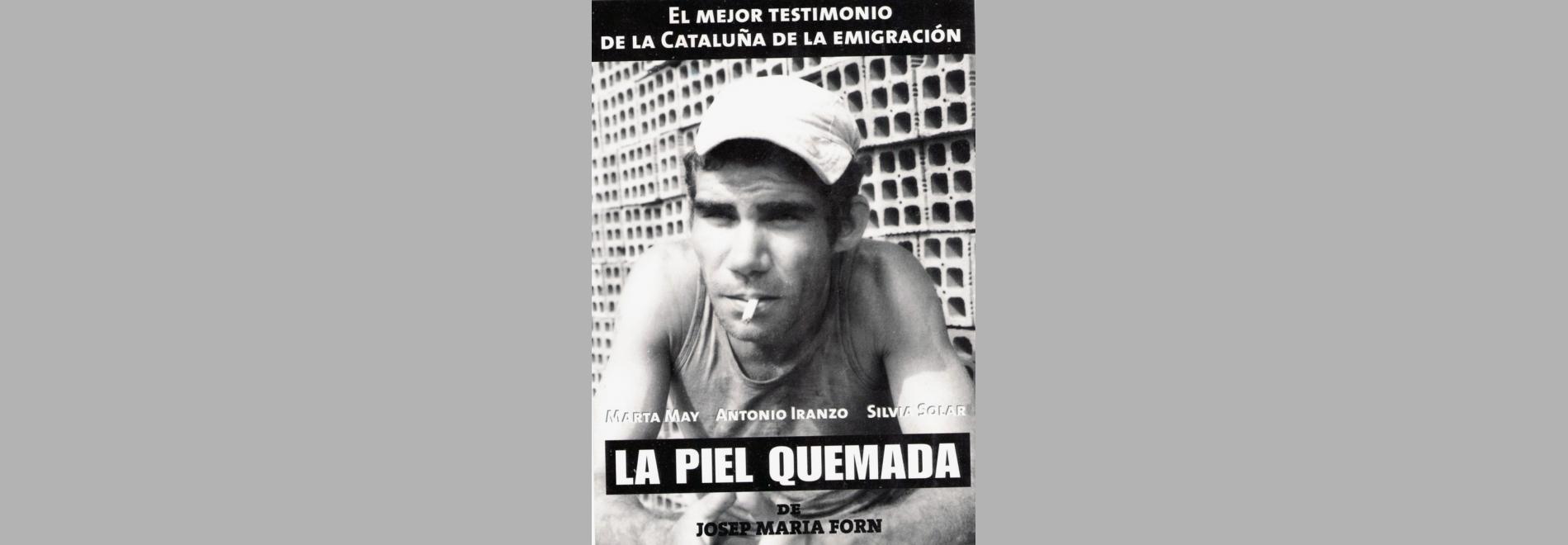 La piel quemada